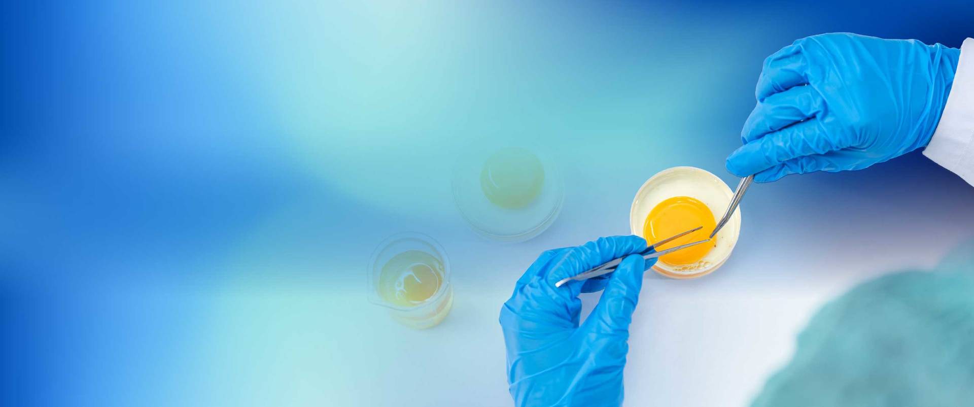 Laboratory hands with blue gloves handling egg sample using tweezers in scientific experiment