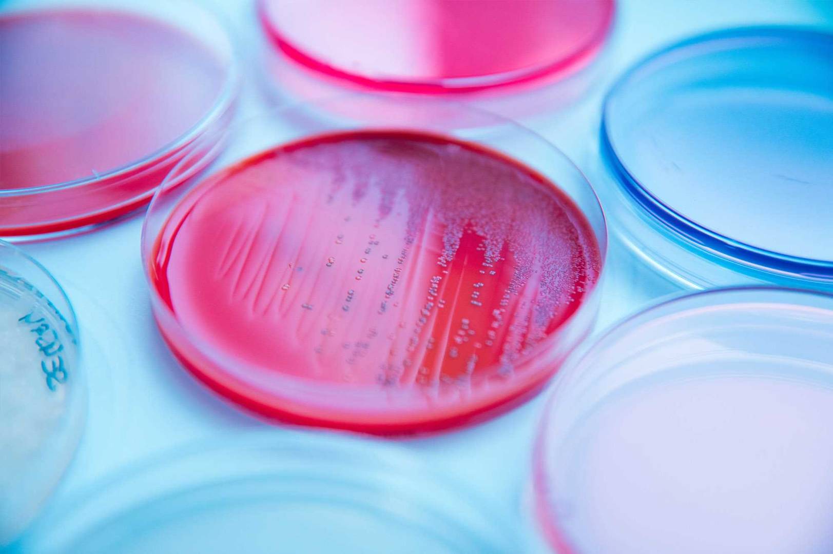 Food  | Mikrobiologie 