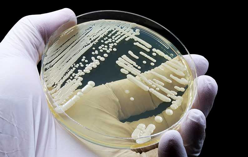 Candida Auris na placa de petri