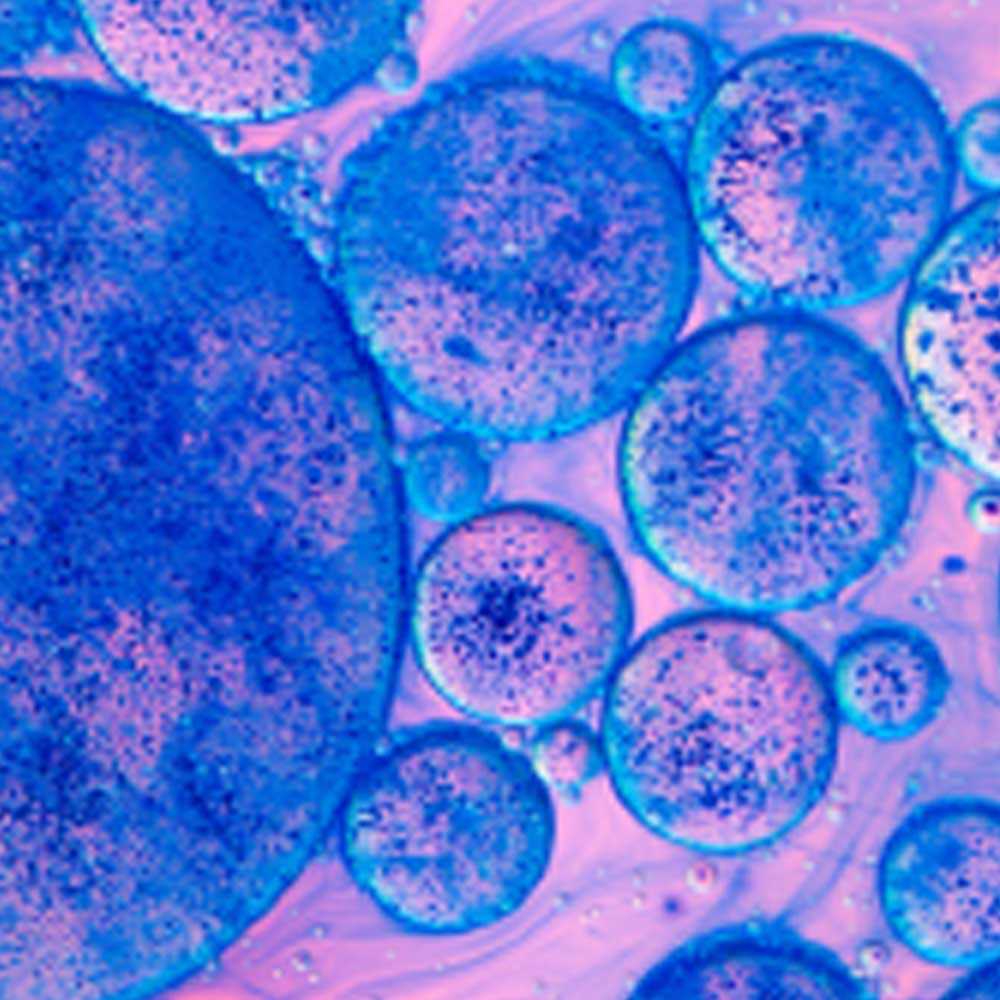 Antimicrobial resistance under microscope