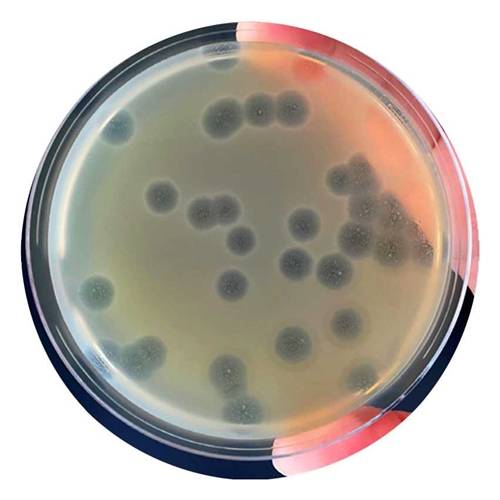 Example of plaques on the petri dish