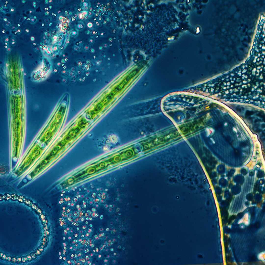 Montage of bacteria
