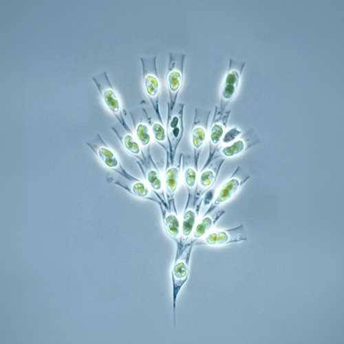 Dinobryon – commonly associated with filter blockages