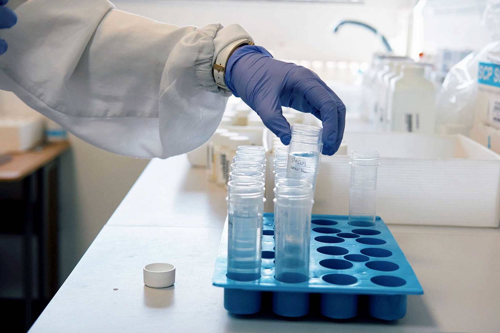 Técnico de laboratório com bata branca e luvas azuis a manusear tubos de ensaio num suporte azul, num ambiente laboratorial.