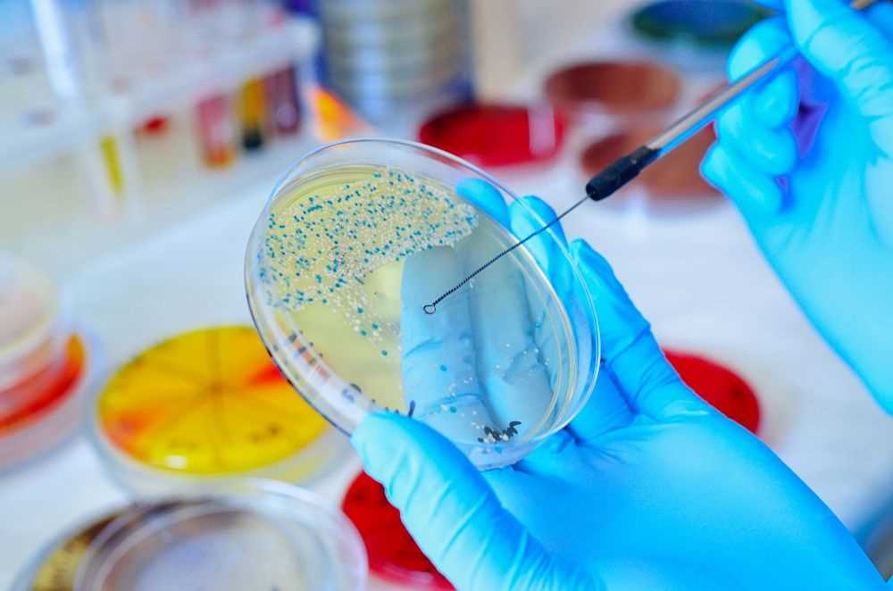 Petriskål med mikrobiella kulturer i laboratorium.