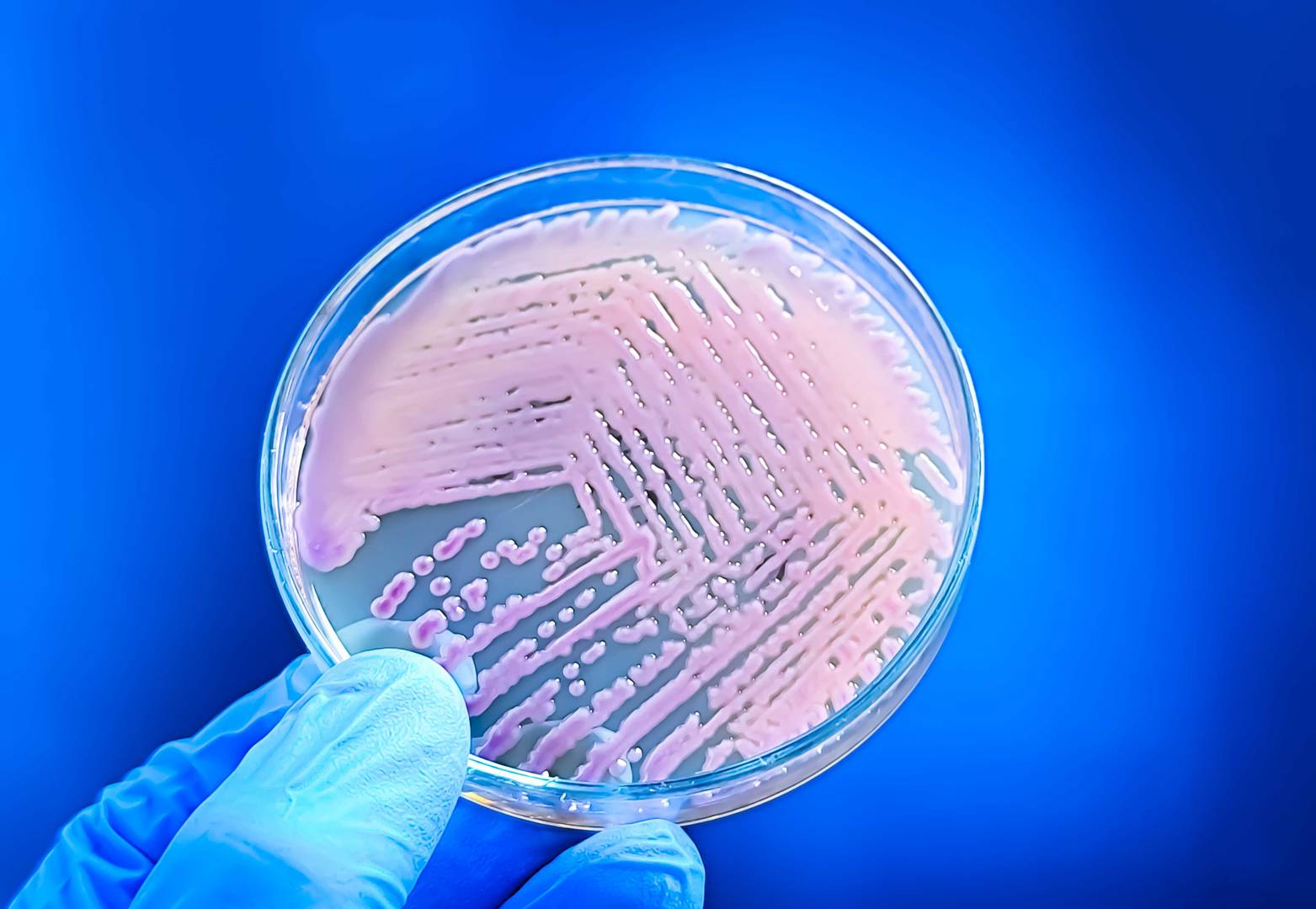 Mikrobiologische Probe